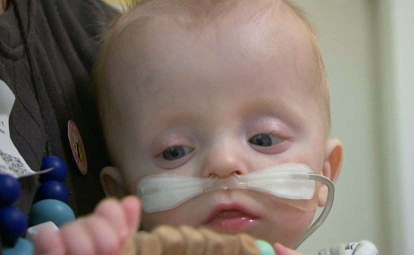 Μωράκι που γεννήθηκε στις 23 εβδομάδες επέζησε μετά από 8 χειρουργεία